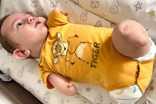Robotické ruce jsou sen nás všech, říká maminka ročního Maxíka, který se narodil bez rukou a nohou - Proženy.cz